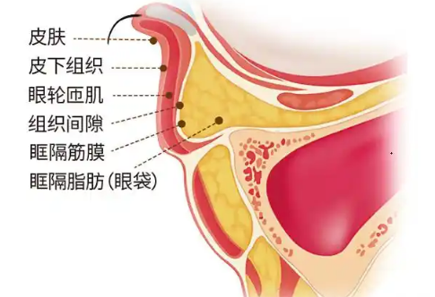 去眼袋手术