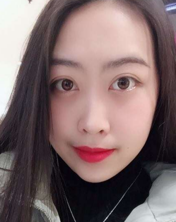 去眼袋手术