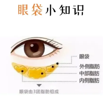 眼袋