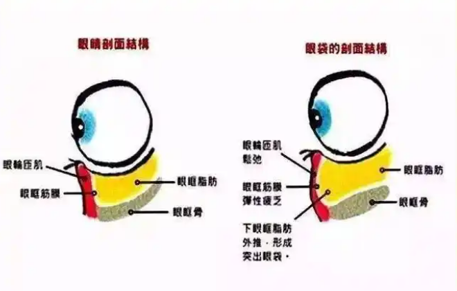 眼袋