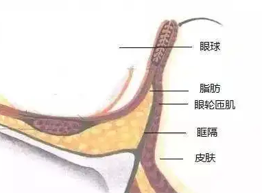 眼袋