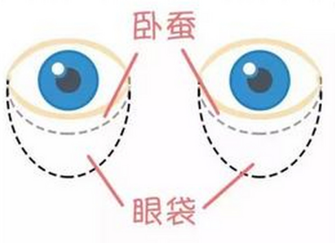 眼袋