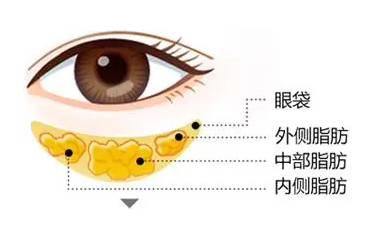 眼袋