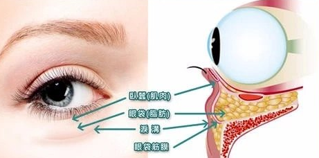 去眼袋手术