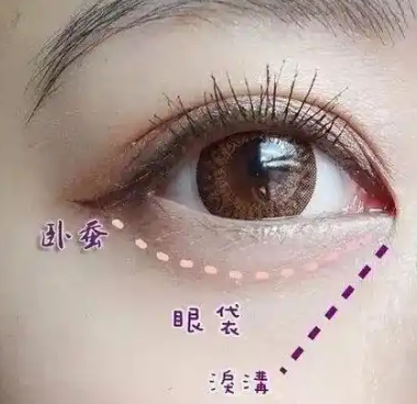 去眼袋手术