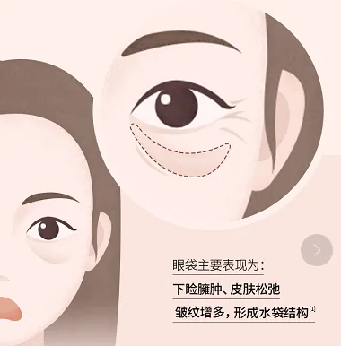 去眼袋手术