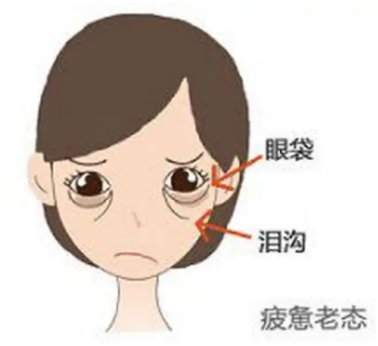去眼袋手术