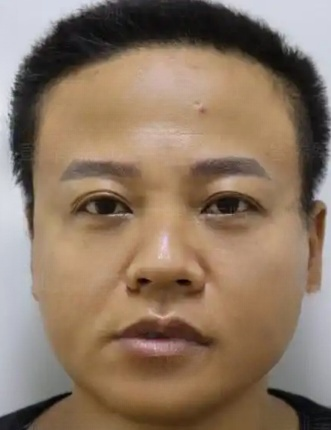 去眼袋手术