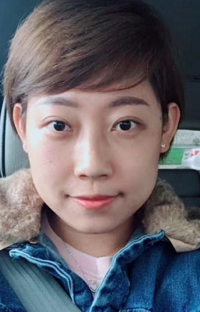 去眼袋手术