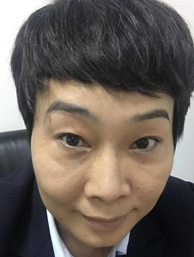 去眼袋手术
