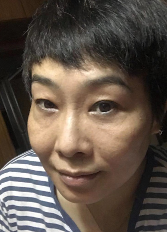 去眼袋手术