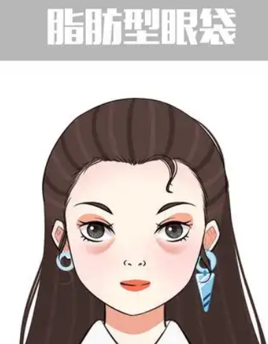 去眼袋手术