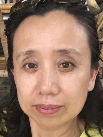 去眼袋手术