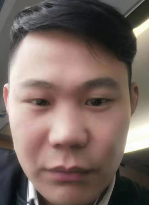 去眼袋手术