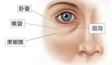 去眼袋手术