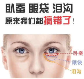 去眼袋手术