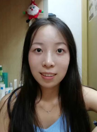 去眼袋手术