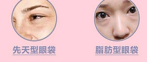 去眼袋手术