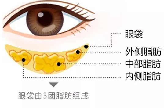 眼袋
