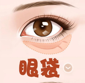 眼袋