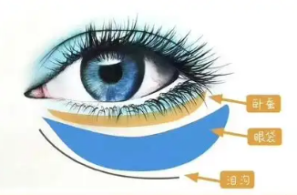 眼袋