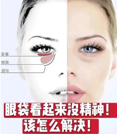 眼袋