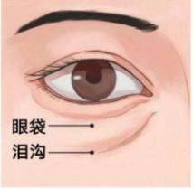 眼袋