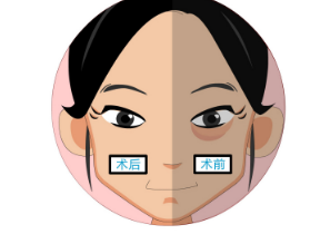 眼袋