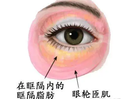 去眼袋手术