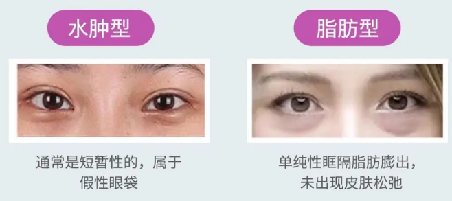 眼袋