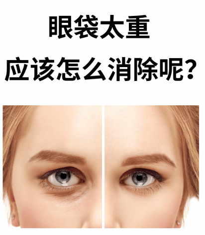 去眼袋手术