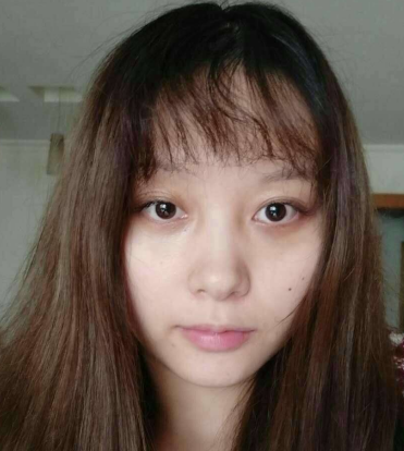 去眼袋手术