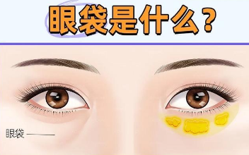 去眼袋手术