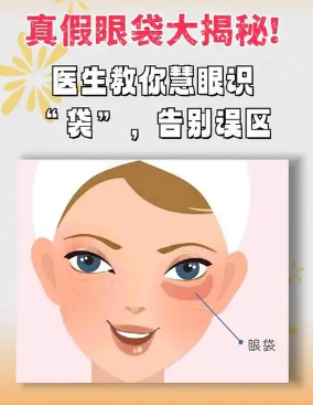去眼袋手术