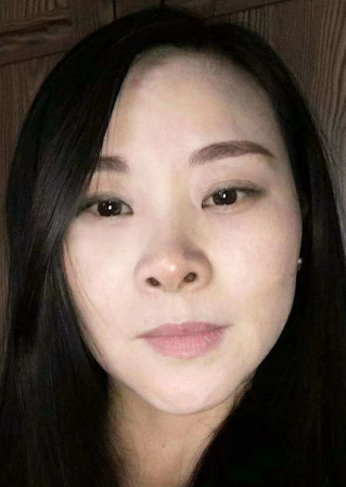 去眼袋手术