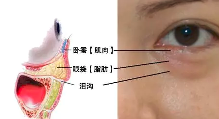 去眼袋手术