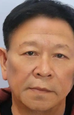 去眼袋手术