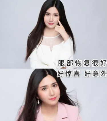 眼袋
