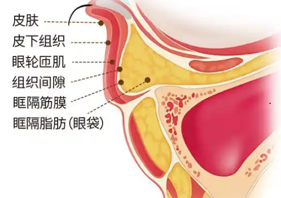 眼袋