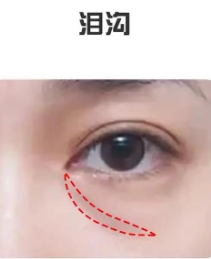眼袋