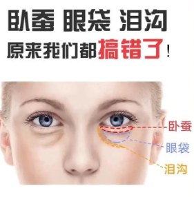 眼袋