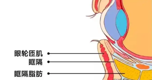 去眼袋手术