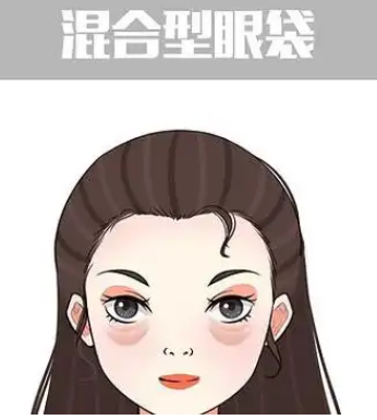 去眼袋手术