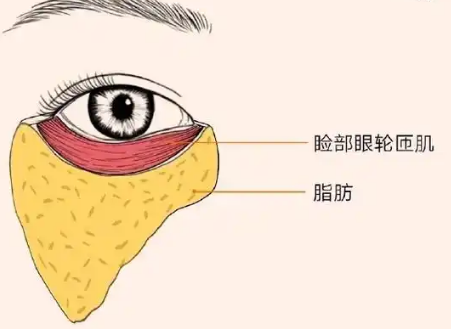 去眼袋手术