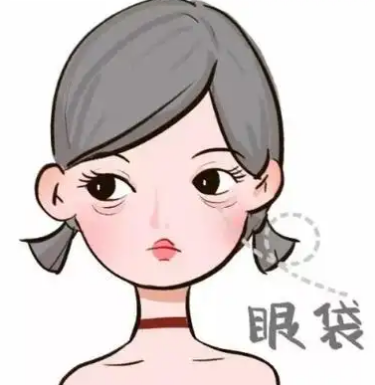 去眼袋手术