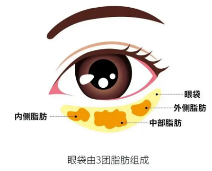 去眼袋手术