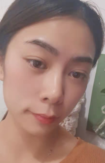 去眼袋手术