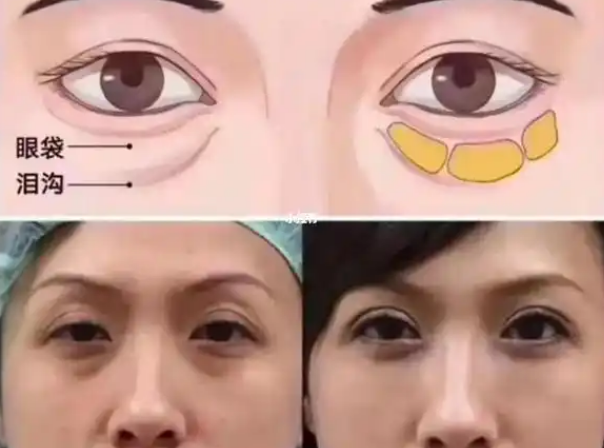۴
