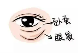 眼袋