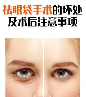 眼袋